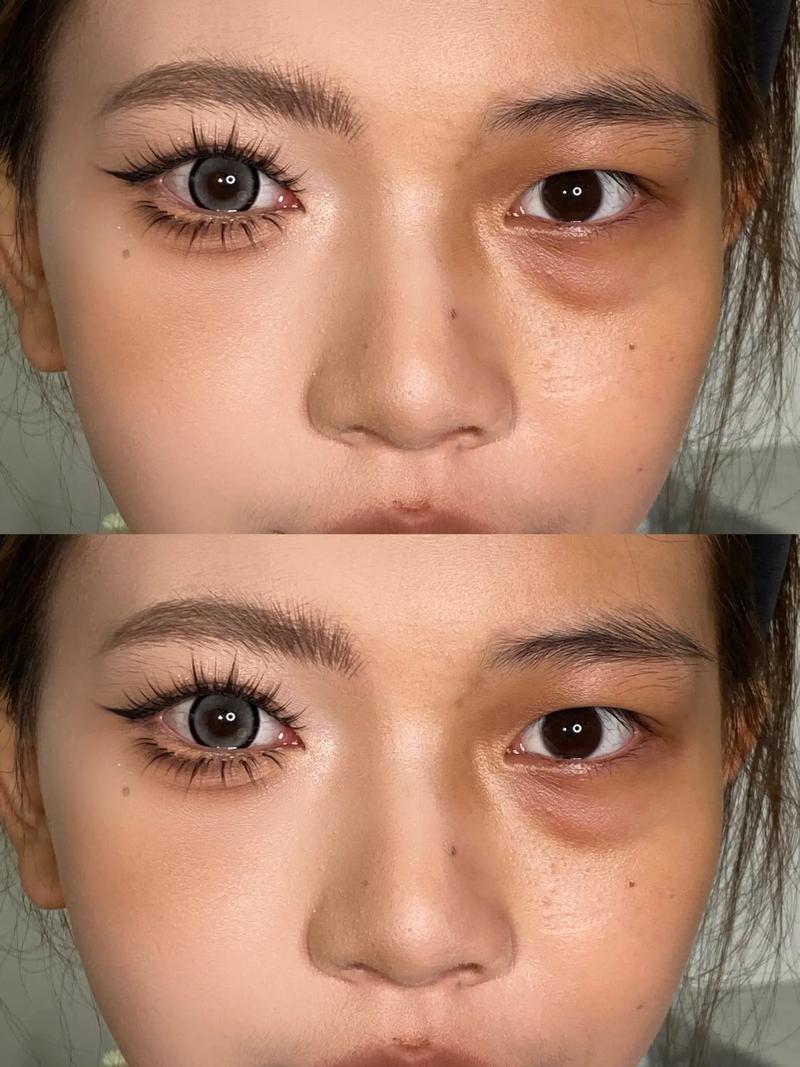 自拍上眼皮微闭_自拍眼睛大_Peter Hurley自拍技巧